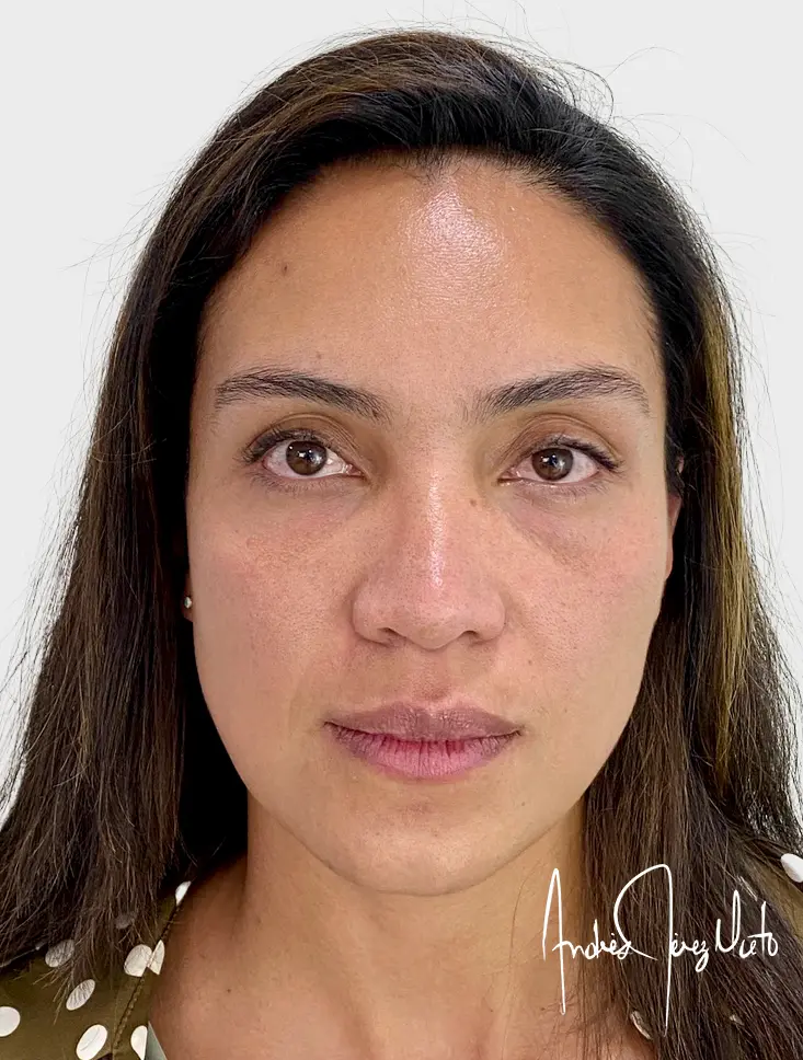 Resultado 1 - DESPUÉS