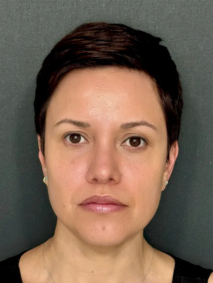 Resultado 2 - DESPUÉS