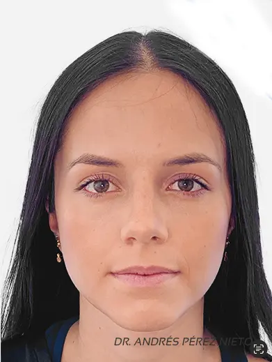 Paciente 1 - Después